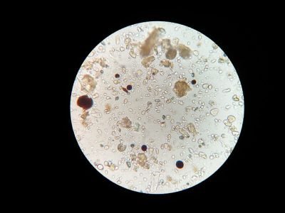 microbes under microscope